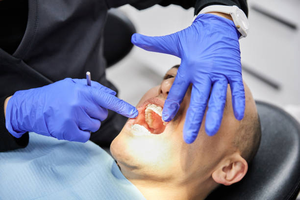 Best Emergency Broken Tooth Repair in Indian Lake, TX